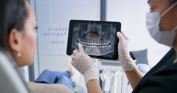 Licensed Tooth Extraction service in Houston, TX - Smile Center Dentistry